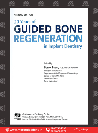 20years of guided bone regeneration in implant dentistry ...